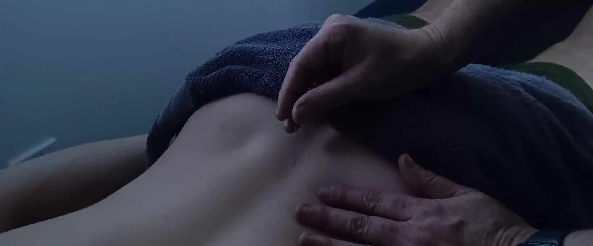 Dry Needling