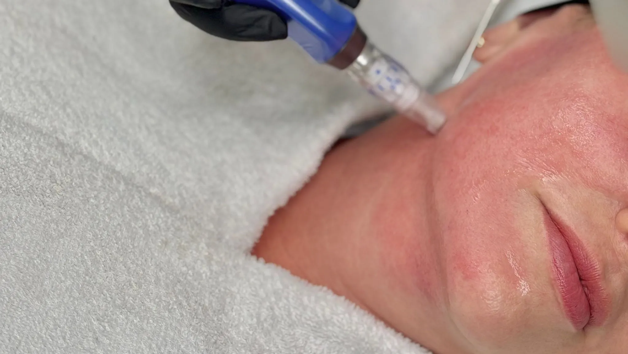 7 Signs Your Skin Barrier Might Be Compromised (Especially in Townsville)